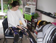 New callipers being put on for physio.